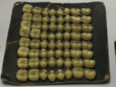 A set of teeth, from the Museum of Dentistry in Edinburgh